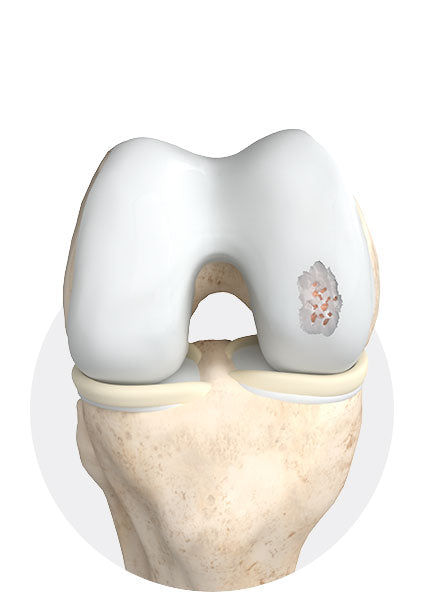 Identify & assess lesion